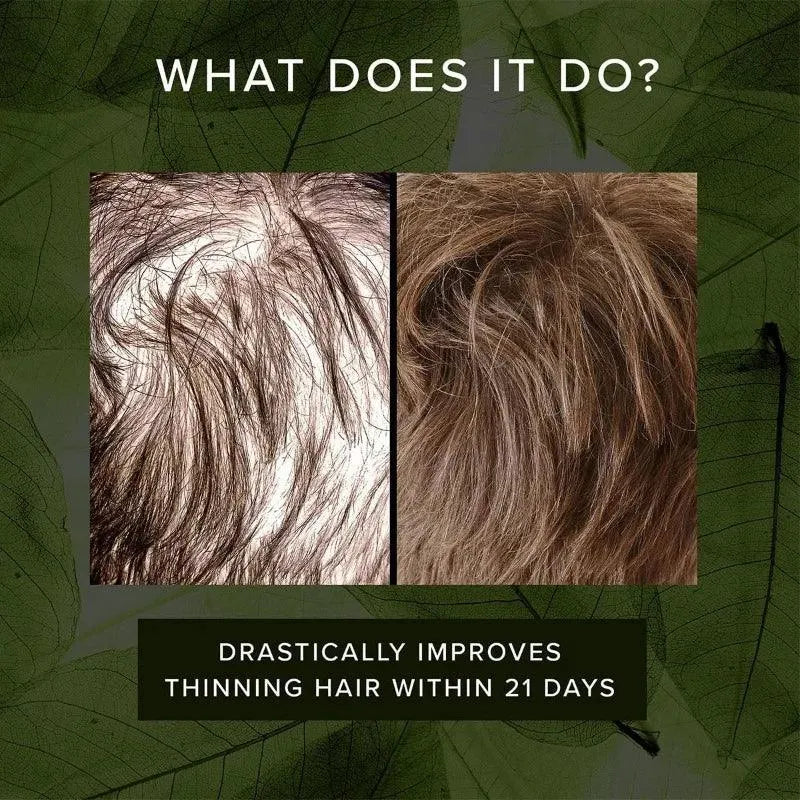 Drastically improve thinning hair and loss of hair in just 21 days!