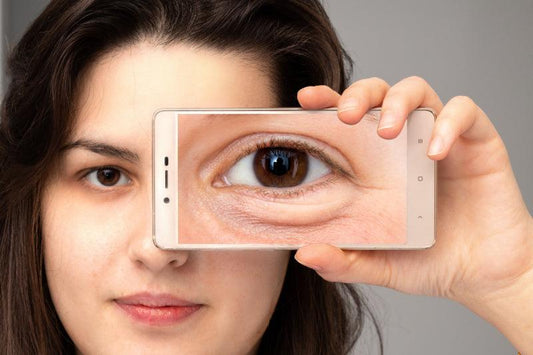 Woman holding cell phone showing under-eye puffiness