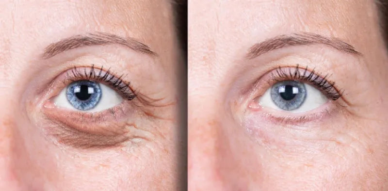 Instant Wrinkle Reducer Creams with Organic Ingredients