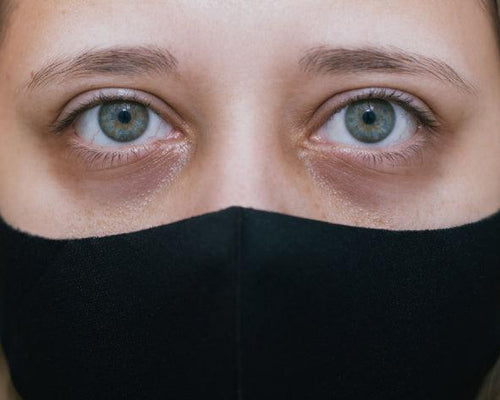 Say Goodbye to Tired, Dark, Racoon Eyes