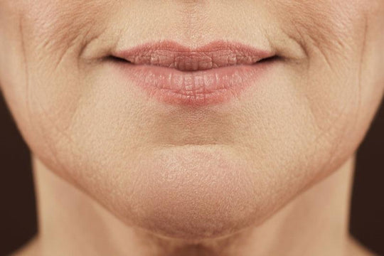 Lose the Lip Lines