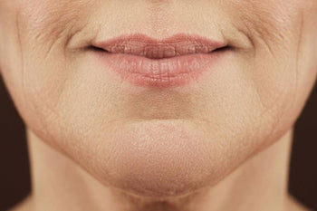 Lose the Lip Lines