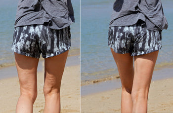 The Smooth Truth About Cellulite