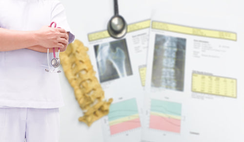 Understanding Osteopenia and Osteoporosis: Symptoms, Causes, and Treatment Options