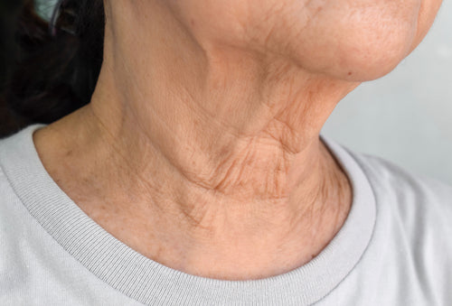 The Truth About ‘Turkey Neck’