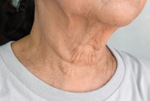 The Truth About ‘Turkey Neck’