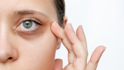The Truth About Dark Circles: Why They Happen, Why They Worsen with Age, and How to Lighten Them