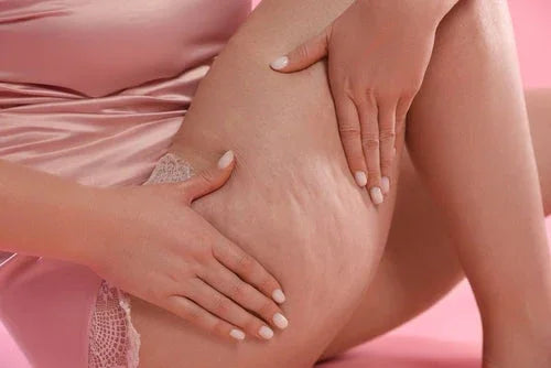 Cellulite Treatments for Mature Skin: What Really Works (and What to Expect)