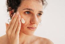 Skincare for Acne-Prone Skin