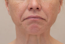 Is Crepey Skin Unavoidable?