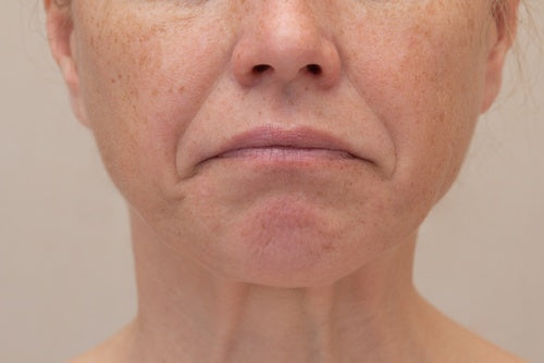 Is Crepey Skin Unavoidable?