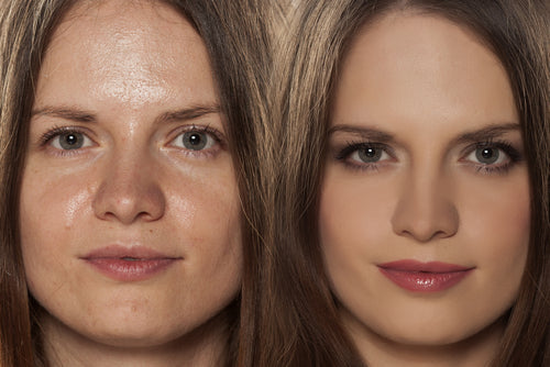 Shine Bright (But Not Too Bright): Top Beauty Tips for Oily Skin and Must-Have Ingredients