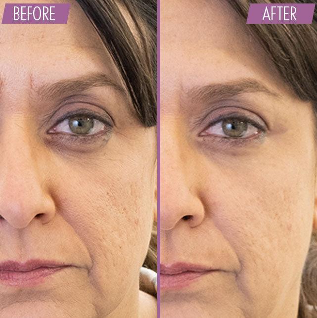 Instant wrinkle concealer