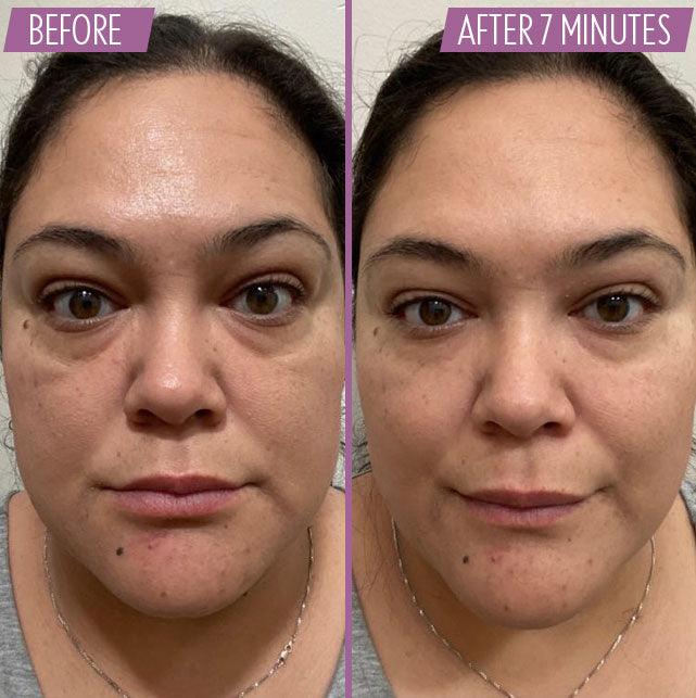Instant facelift