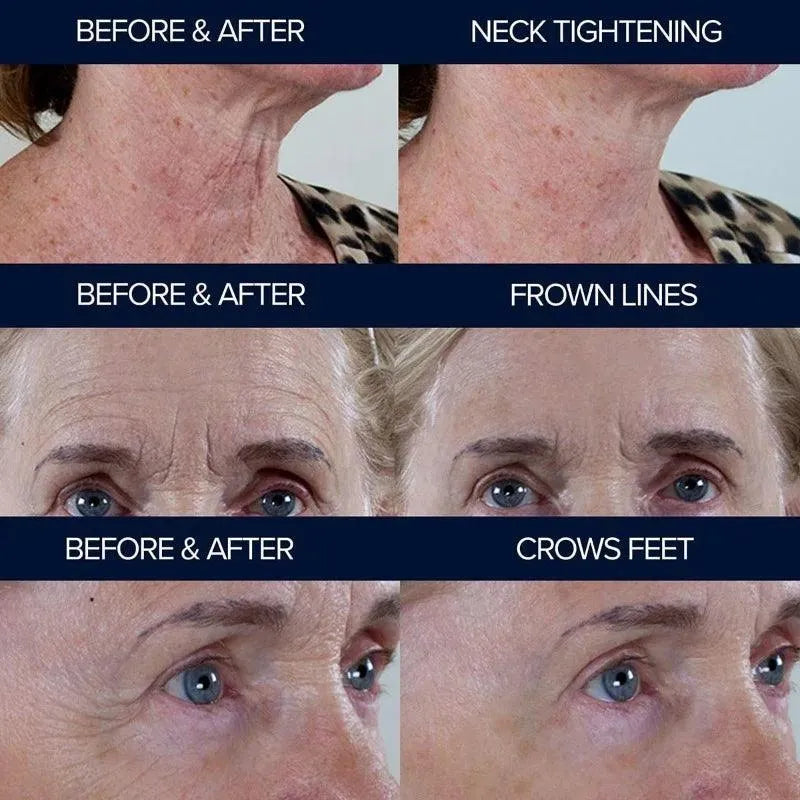 Before and After Photos - Peptide 10 by Adonia Organics