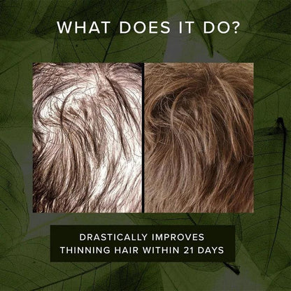 Drastically improve thinning hair and loss of hair in just 21 days!