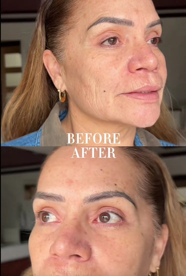 Before and After compilation of wrinkle filler serum Peptide 10 by Adonia Organics.